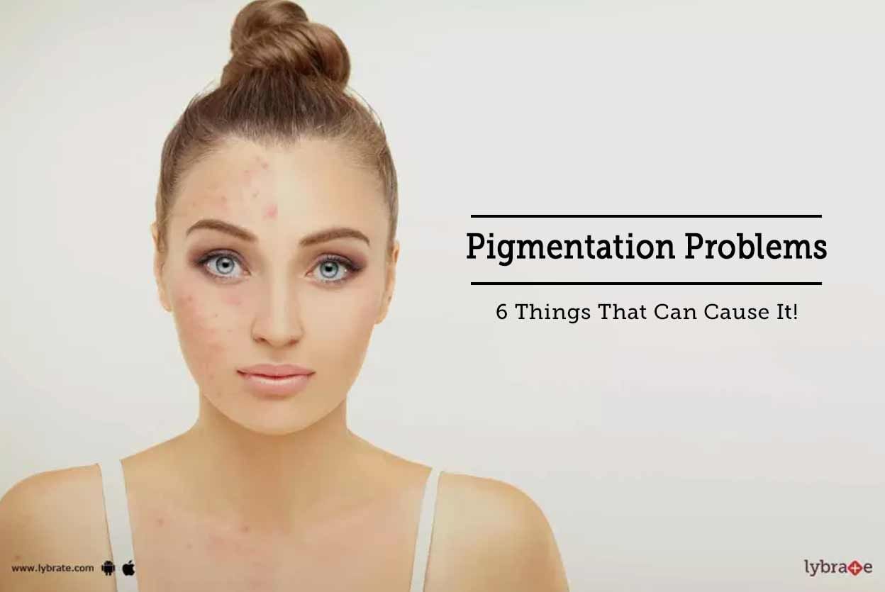 Pigmentation Problems - 6 Things That Can Cause It!