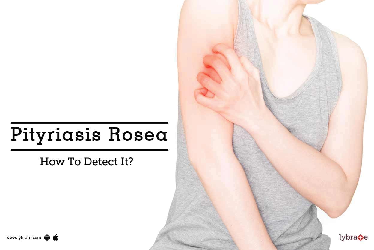 Pityriasis Rosea - How To Detect It?