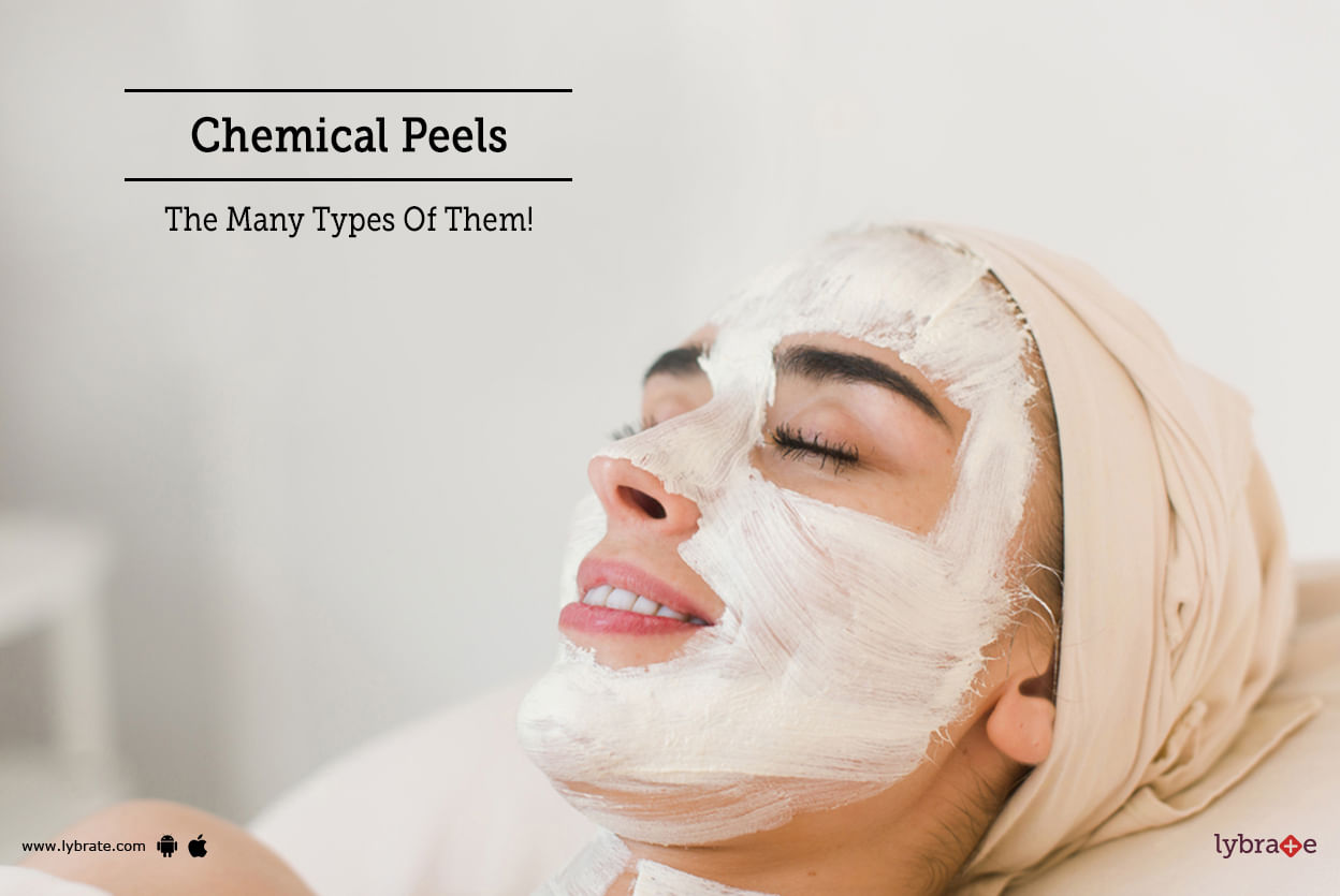 Chemical Peels - The Many Types Of Them!