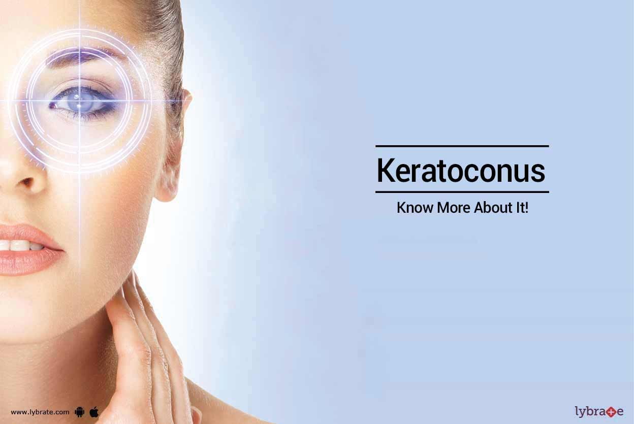 Keratoconus - Know More About It!