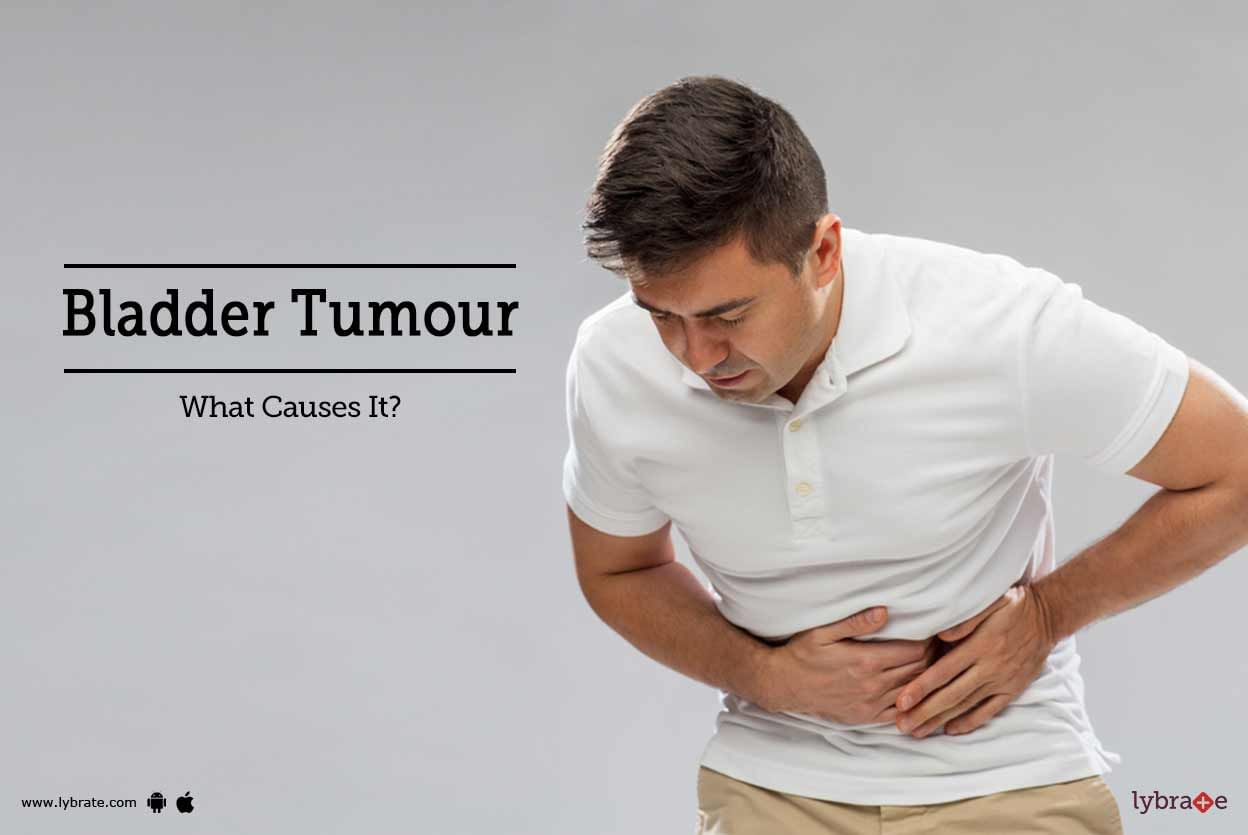 Bladder Tumour - What Causes It?