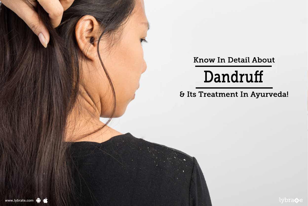 Know In Detail About Dandruff & Its Treatment In Ayurveda!