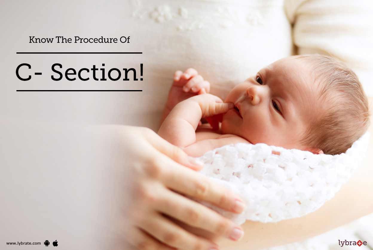 Know The Procedure Of C- Section!