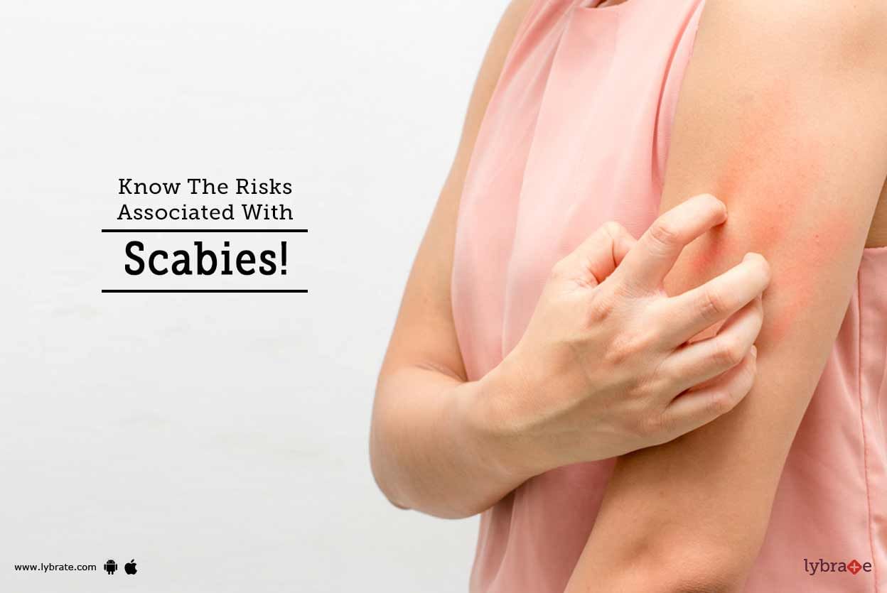 Know The Risks Associated With Scabies!