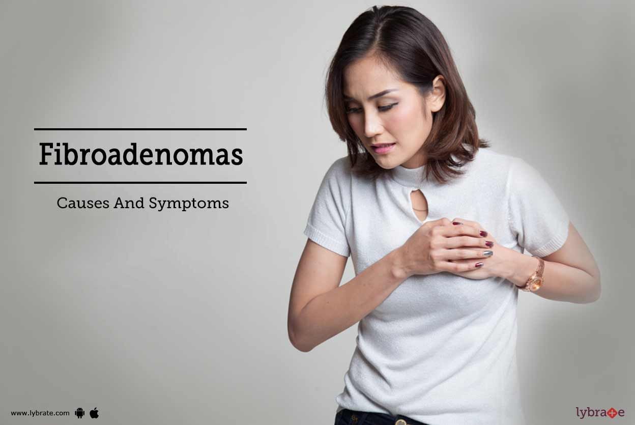 Fibroadenomas - Causes And Symptoms