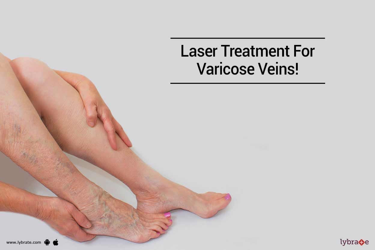 Laser Treatment For Varicose Veins!