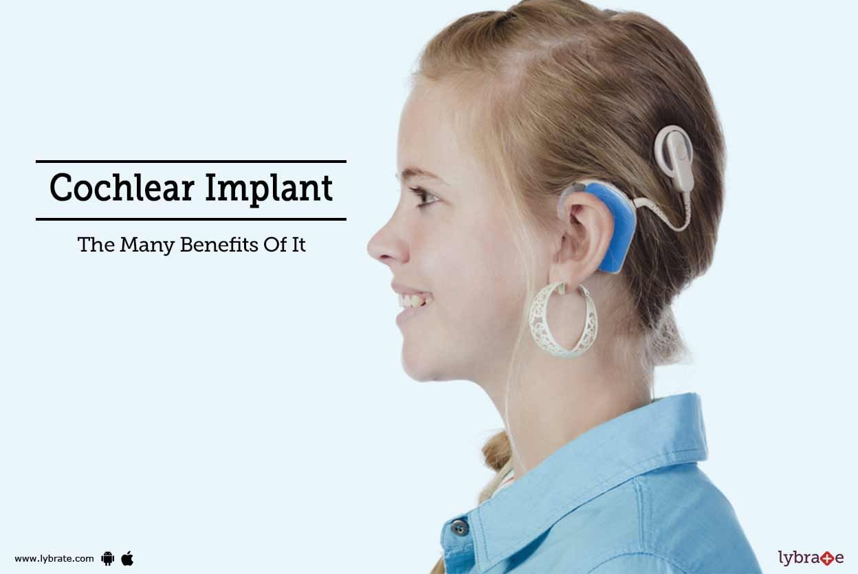 Cochlear Implant - The Many Benefits Of It