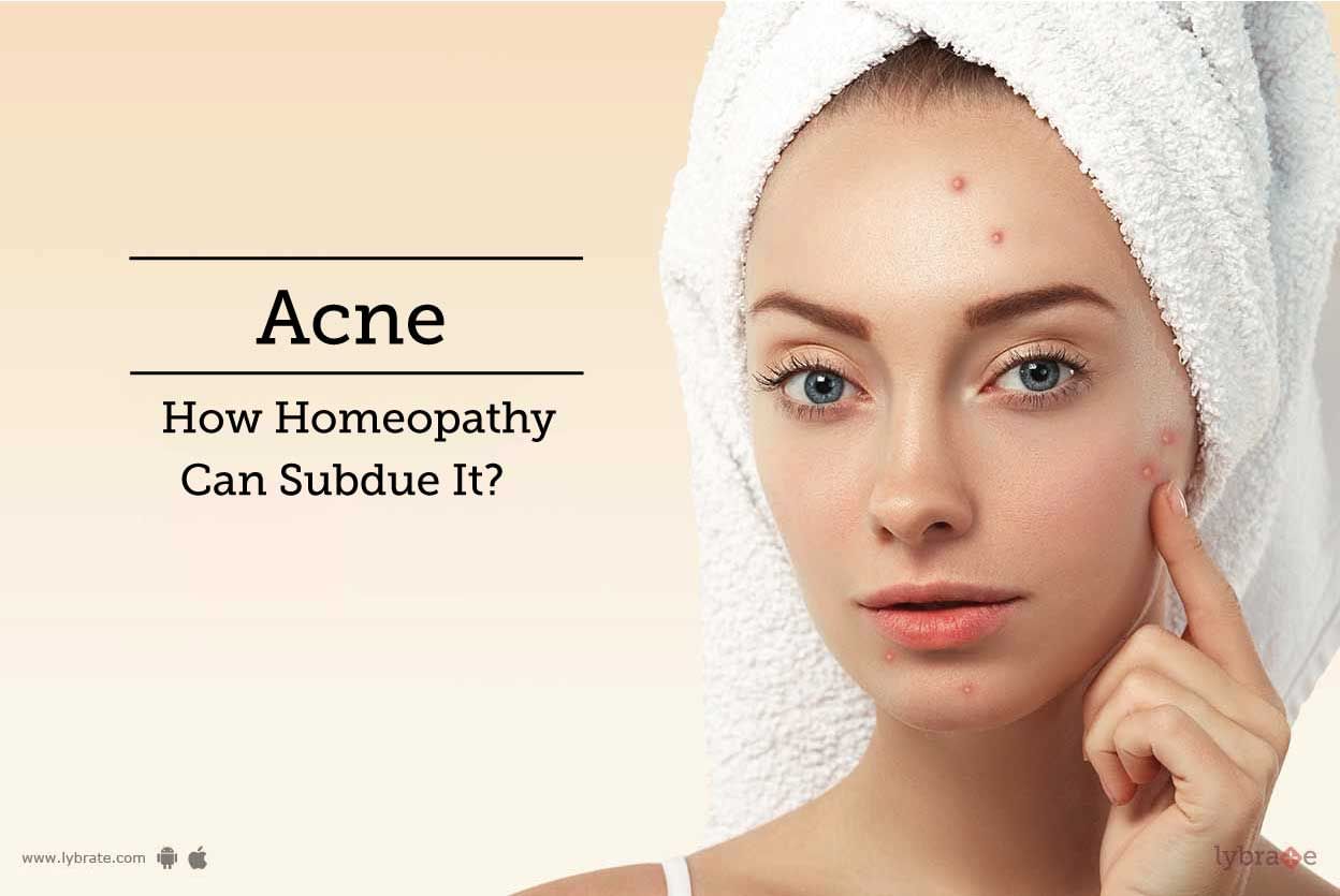 Acne - How Homeopathy Can Subdue It?