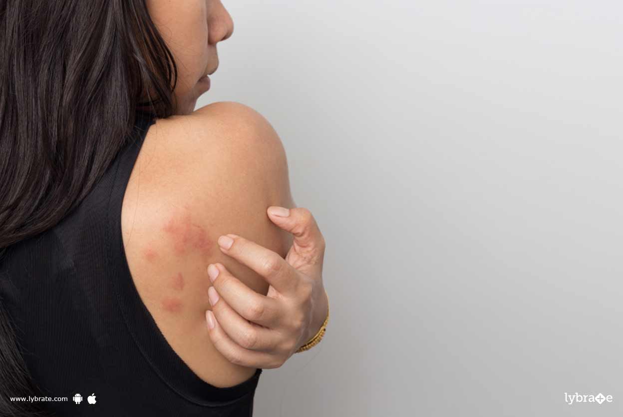 Common Skin Diseases - Know How Ayurveda Can Be Of Help!
