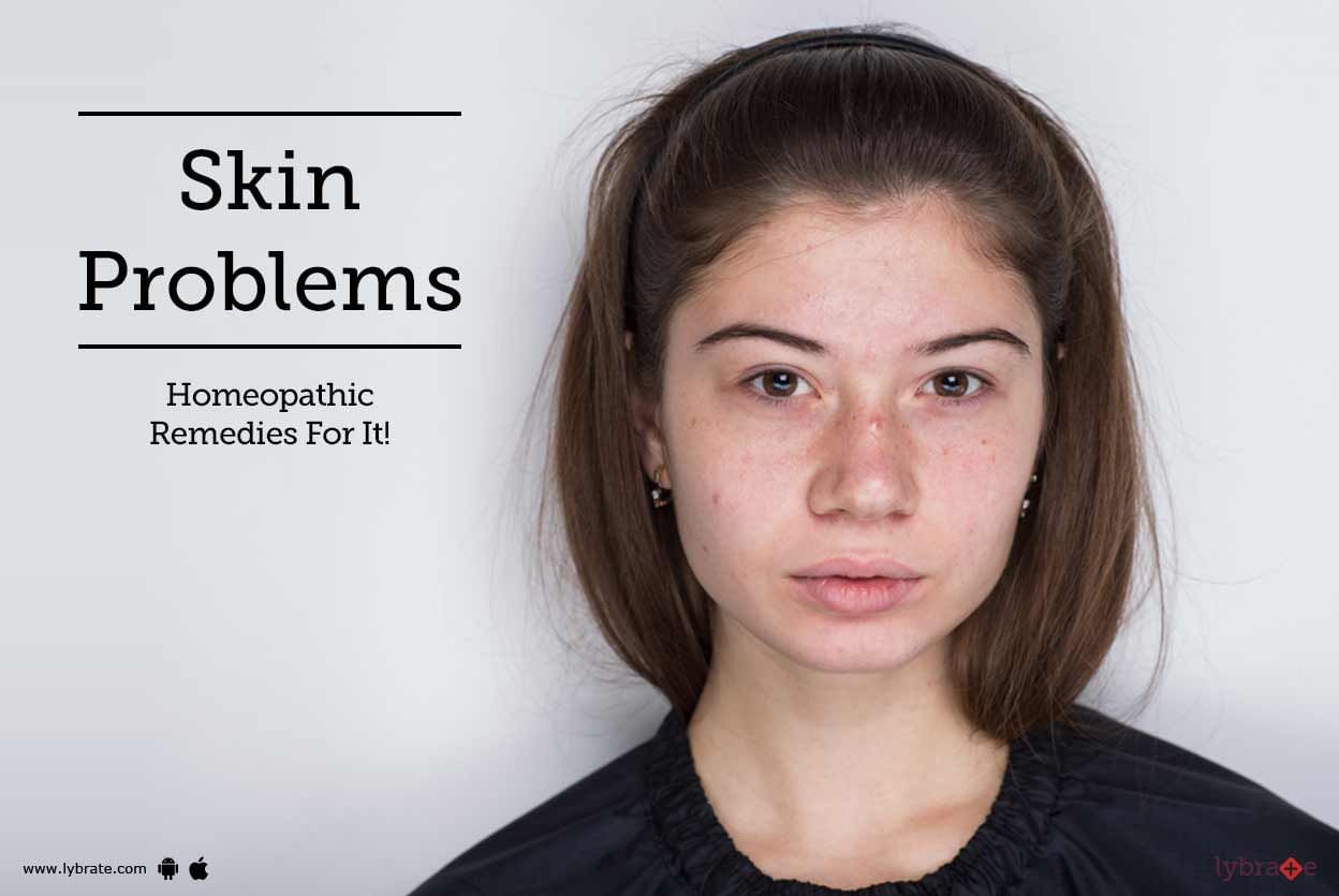 Skin Problems - Homeopathic Remedies For It!