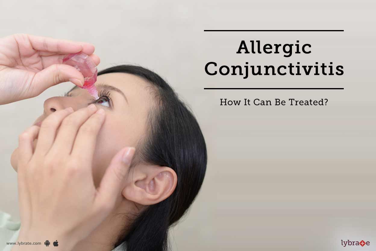Allergic Conjunctivitis - How It Can Be Treated?