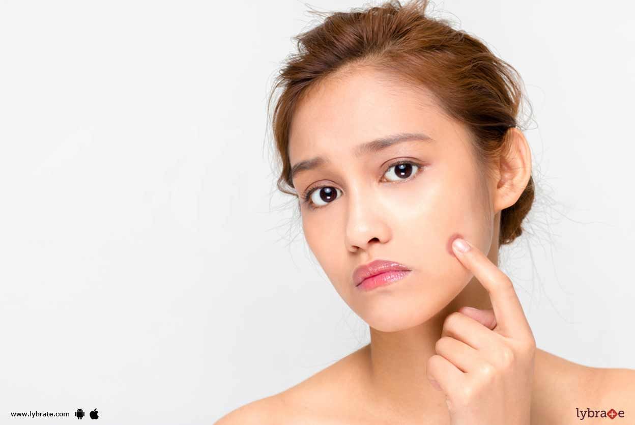 Blemishes - How To Handle Them?