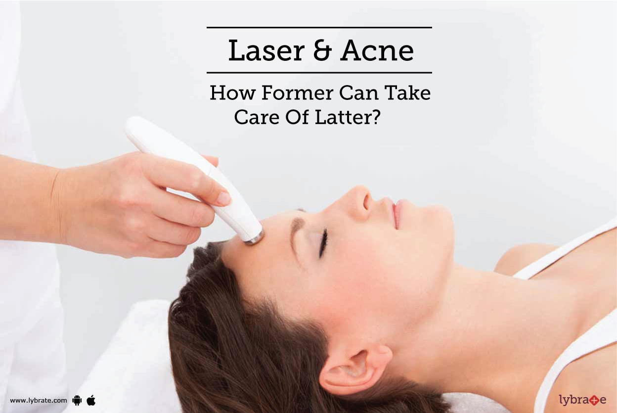 Laser & Acne - How Former Can Take Care Of Latter?