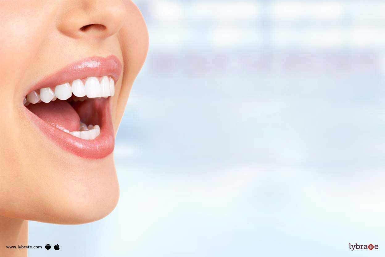 Dental Implants - Know More About Them!