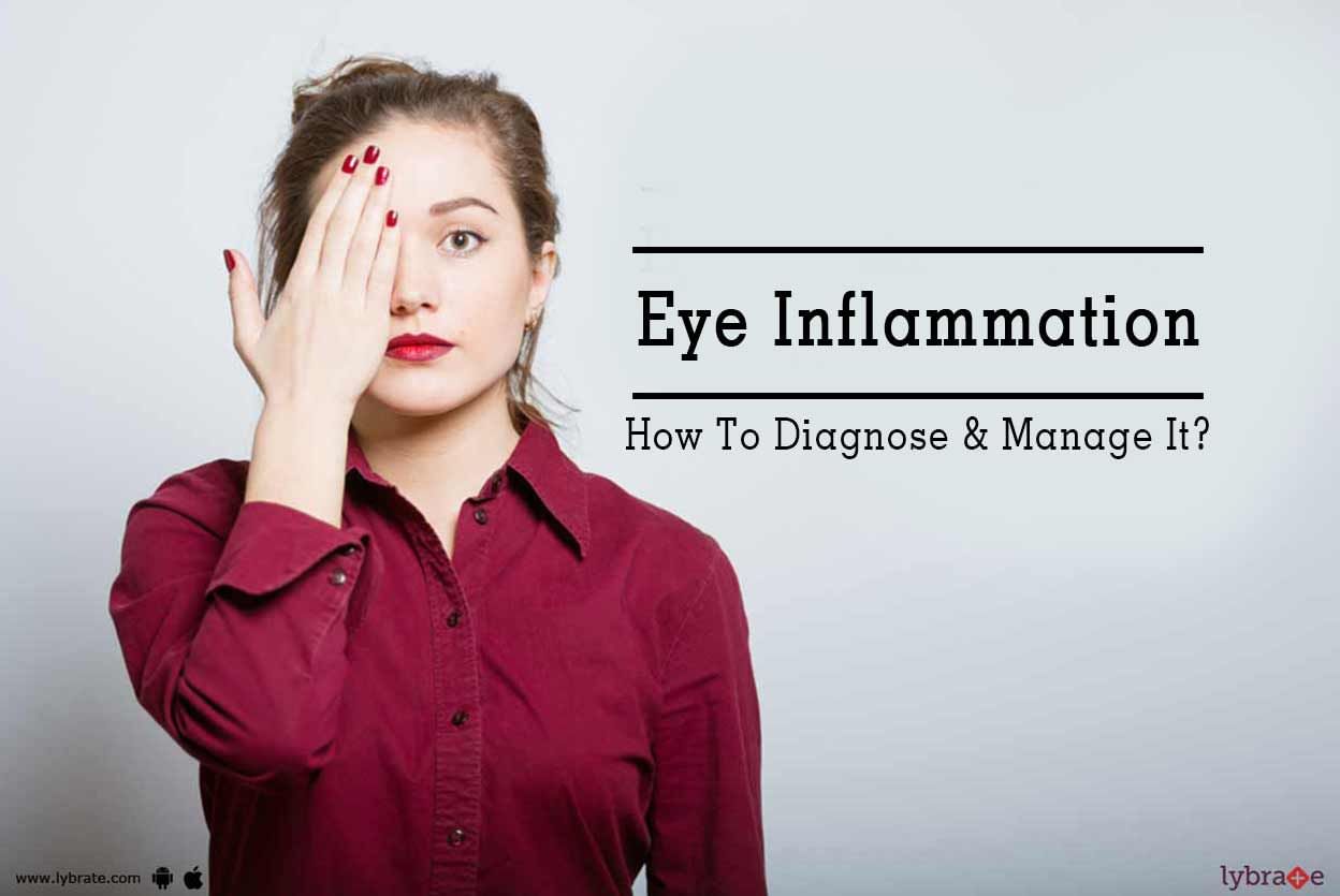 Eye Inflammation - How To Diagnose & Manage It?