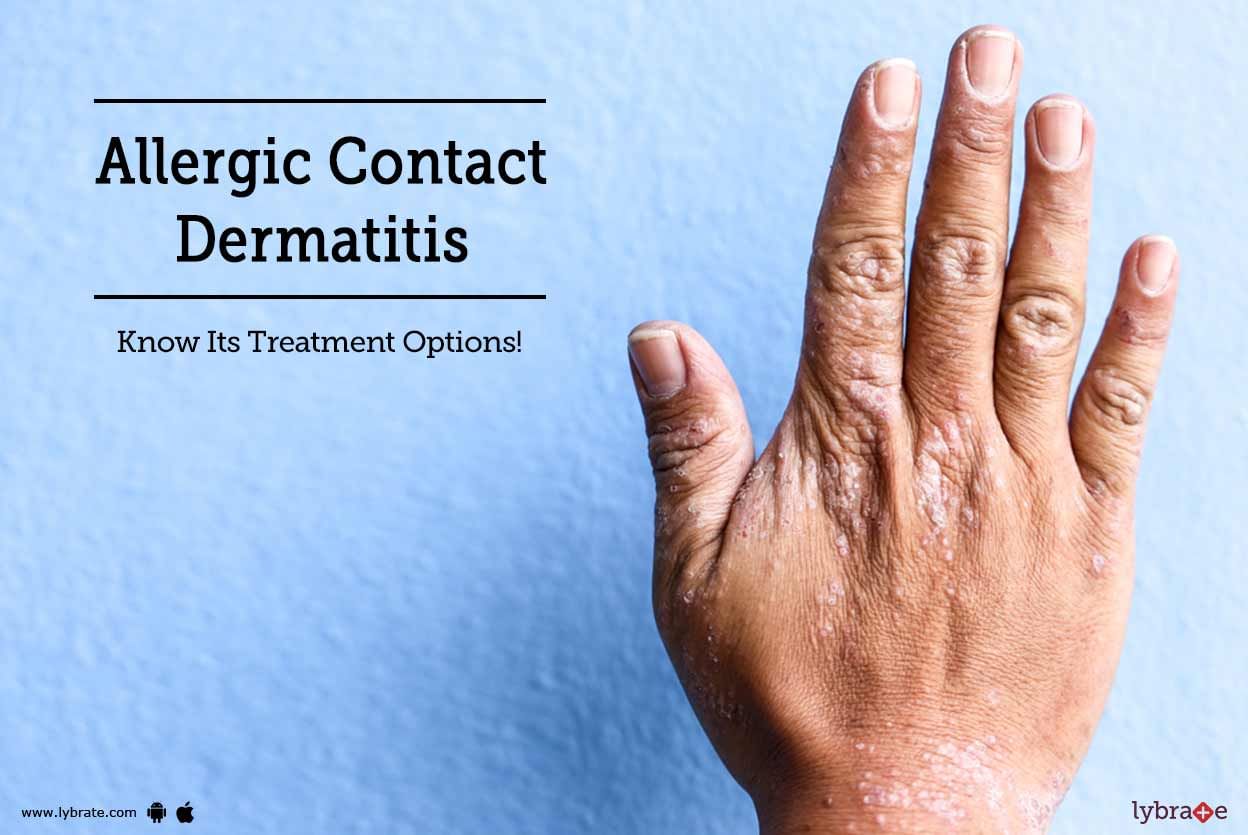 Allergic Contact Dermatitis - Know Its Treatment Options!
