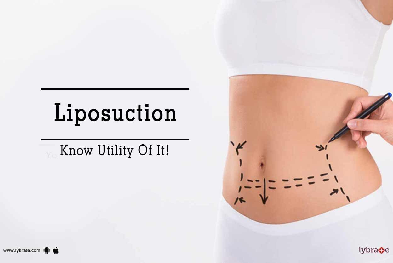 Liposuction - Know Utility Of It!