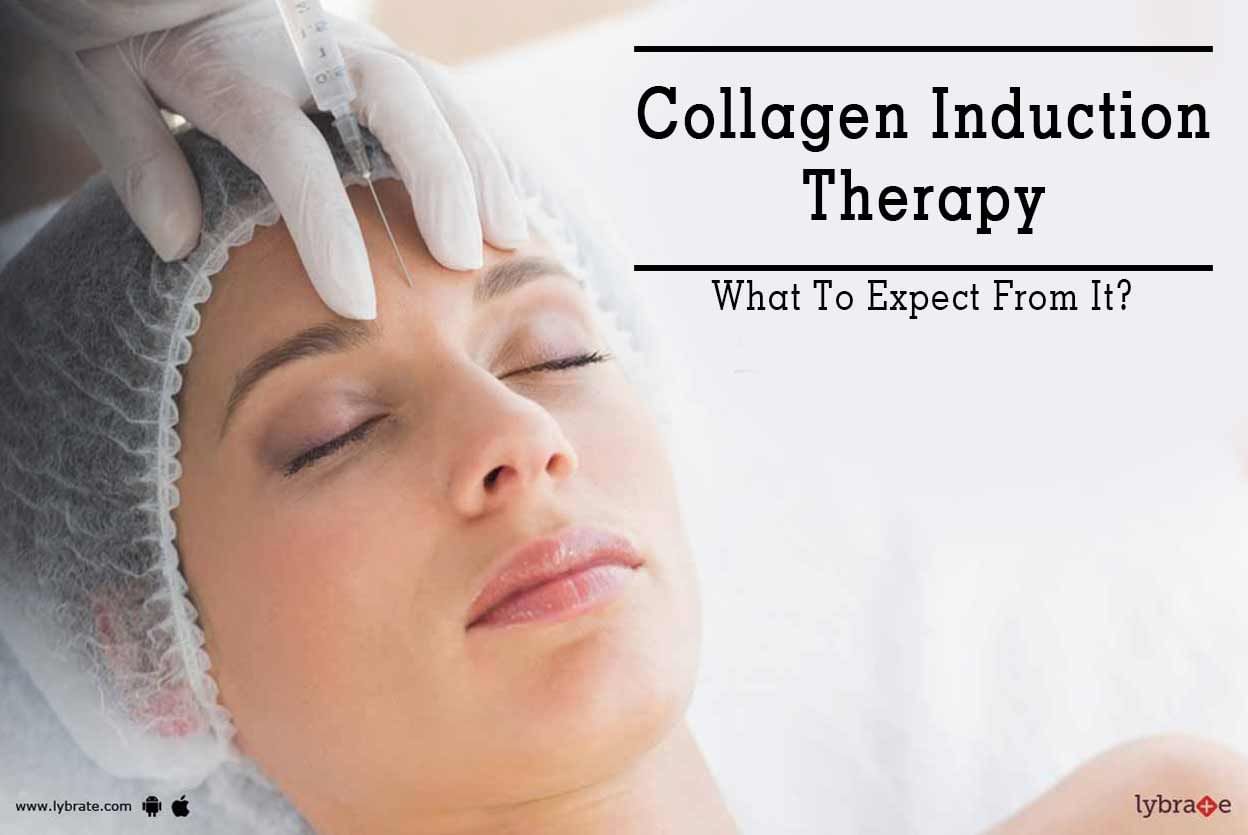 Collagen Induction Therapy - What To Expect From It?