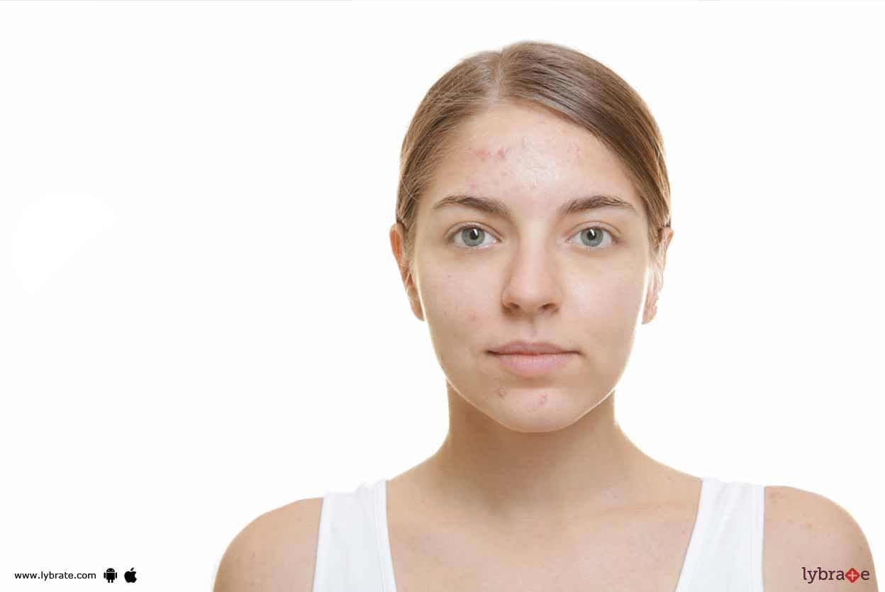 Skin Problems - Have Ayurveda For Them!