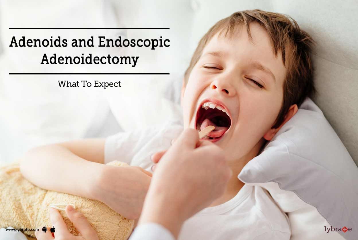 Adenoids and Endoscopic Adenoidectomy - What To Expect