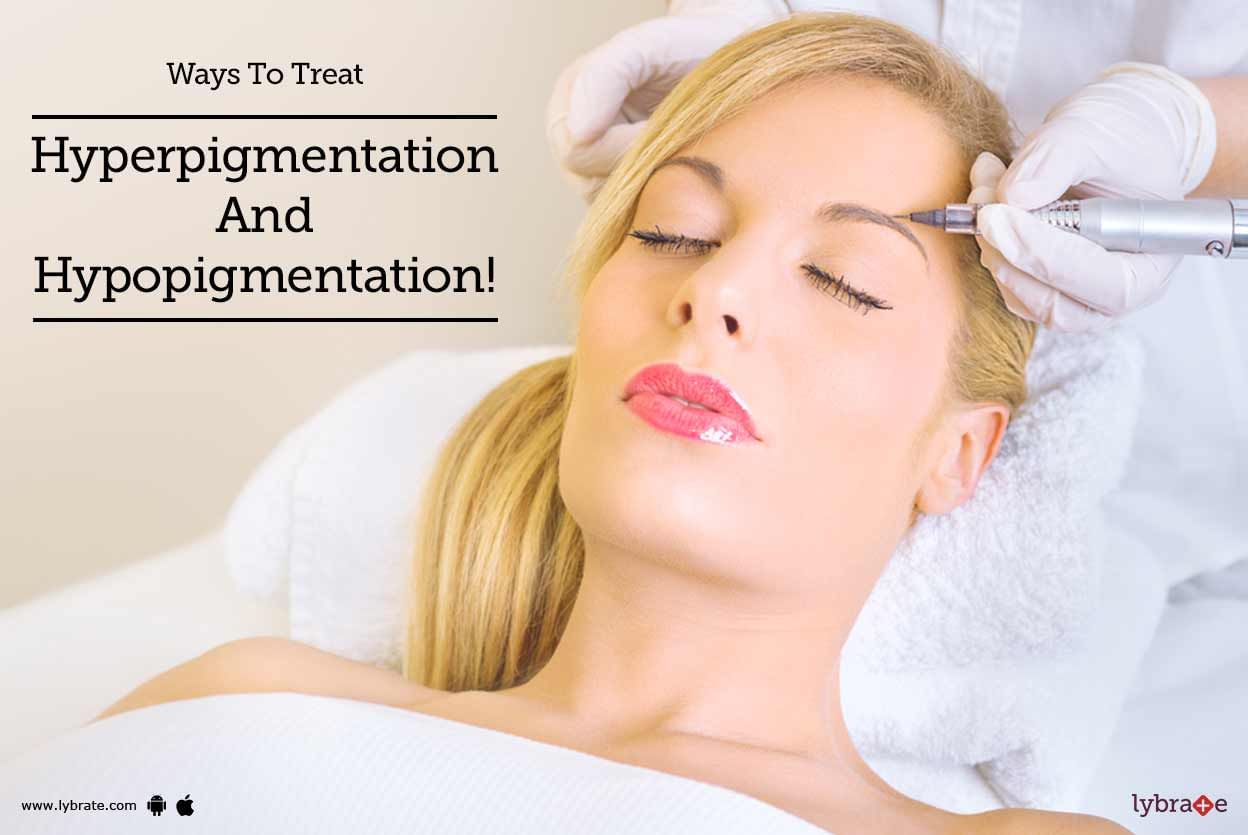 Ways To Treat Hyperpigmentation And Hypopigmentation!