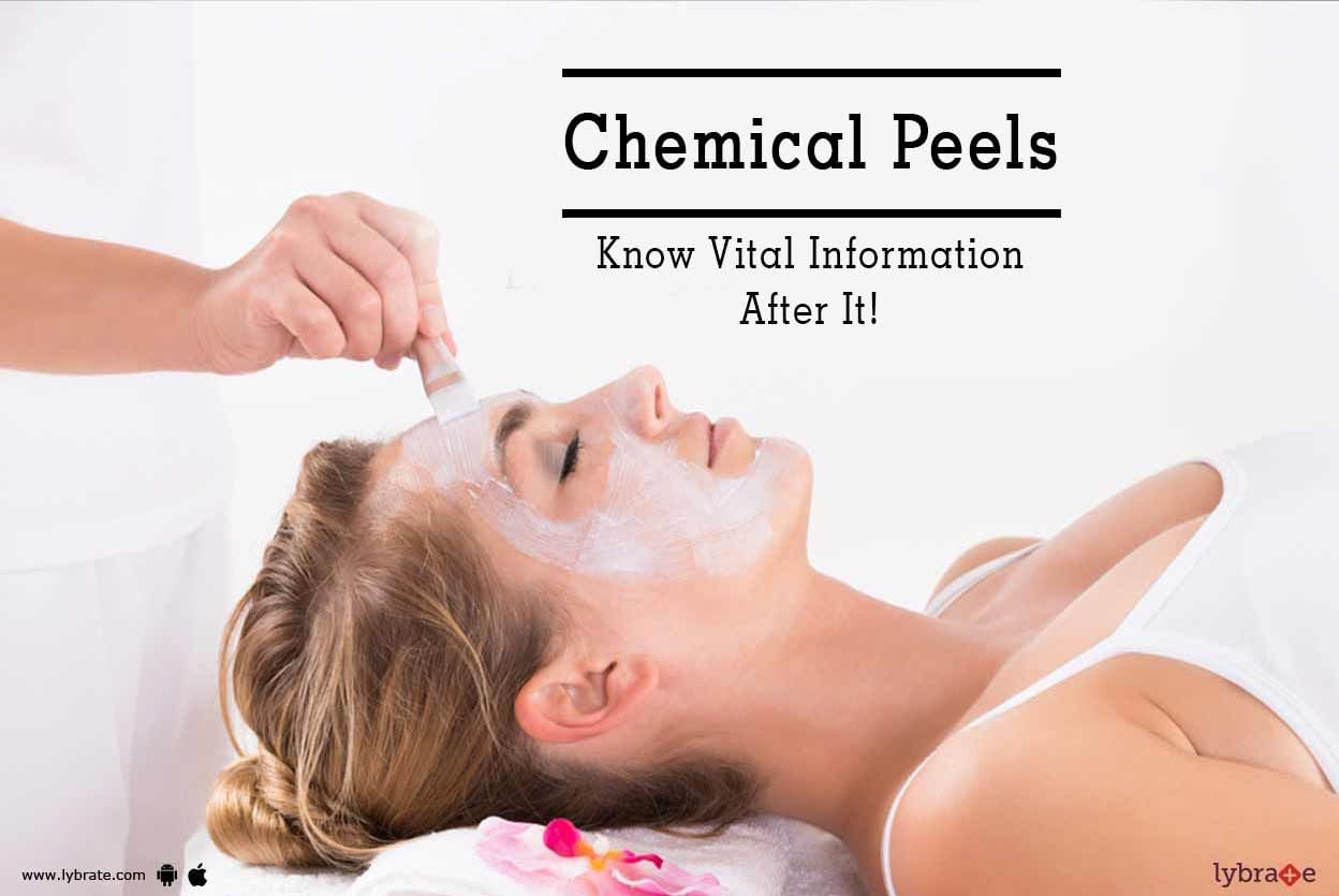 Chemical Peels - Know Vital Information After It!