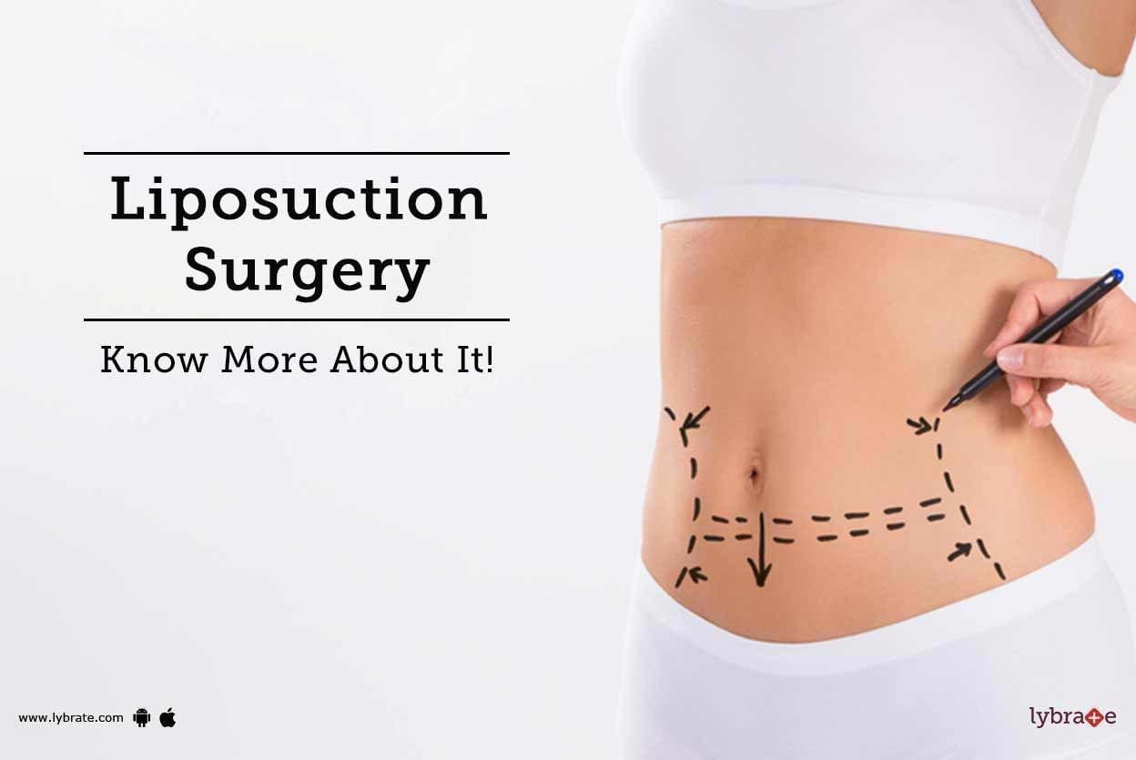 Liposuction Surgery - Know More About It!