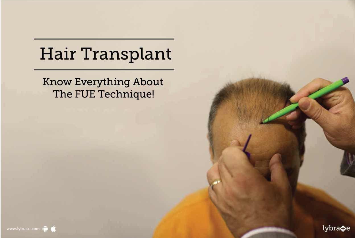 Hair Transplant - Know Everything About The FUE Technique!
