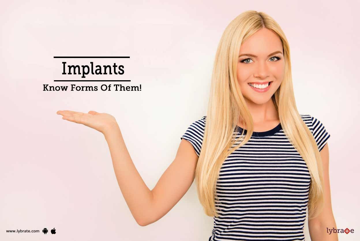 Implants - Know Forms Of Them!