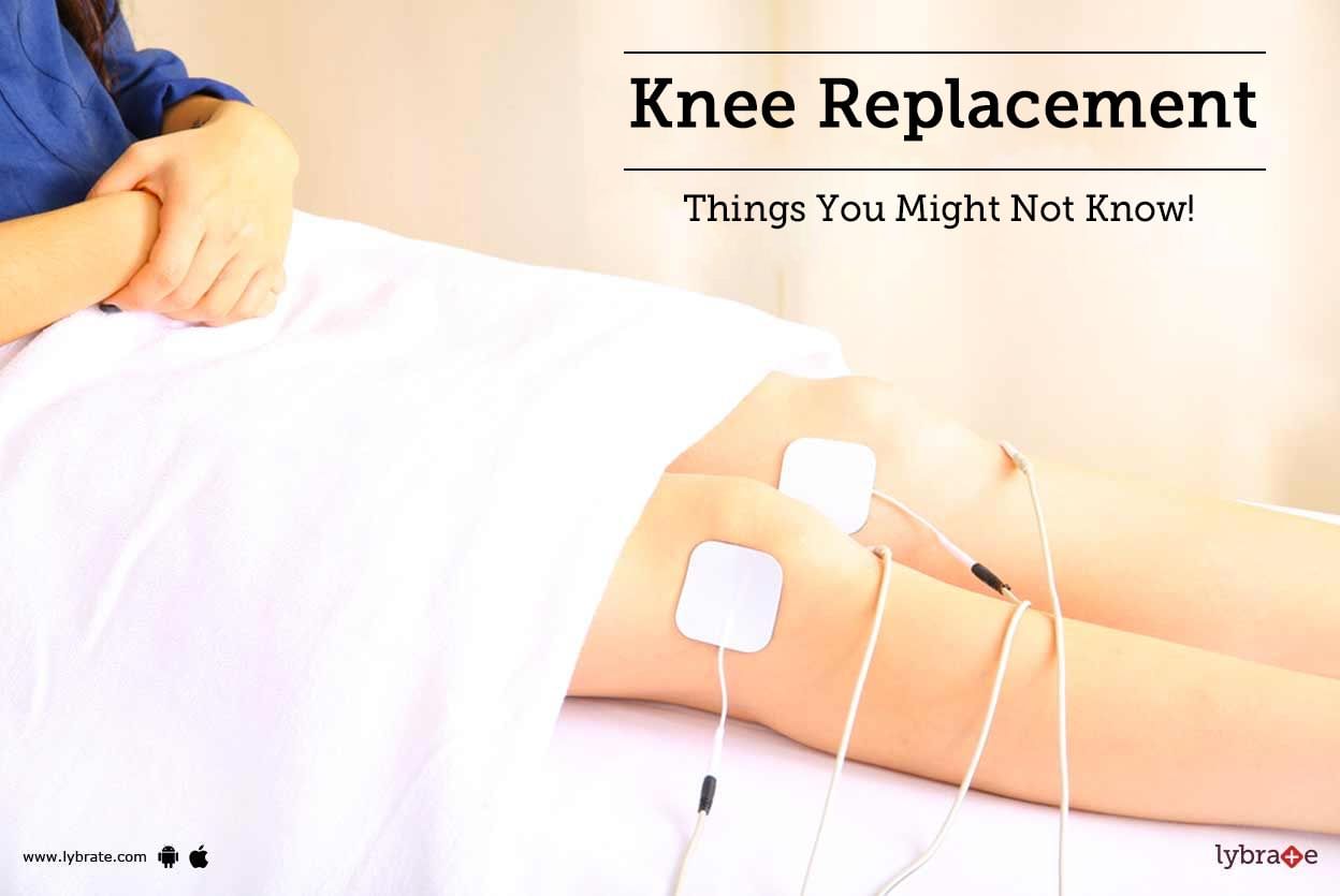 Knee Replacement - Things You Might Not Know!