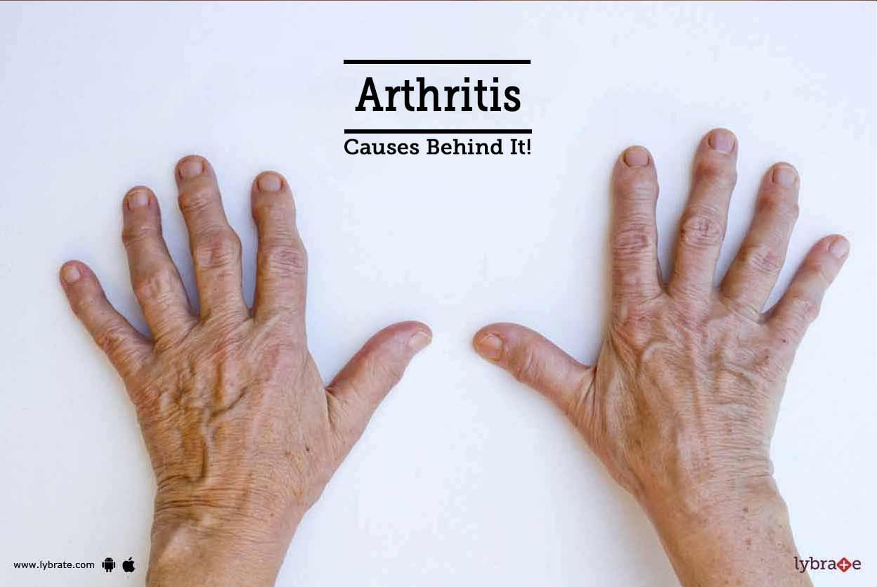 Arthritis - Causes Behind It!