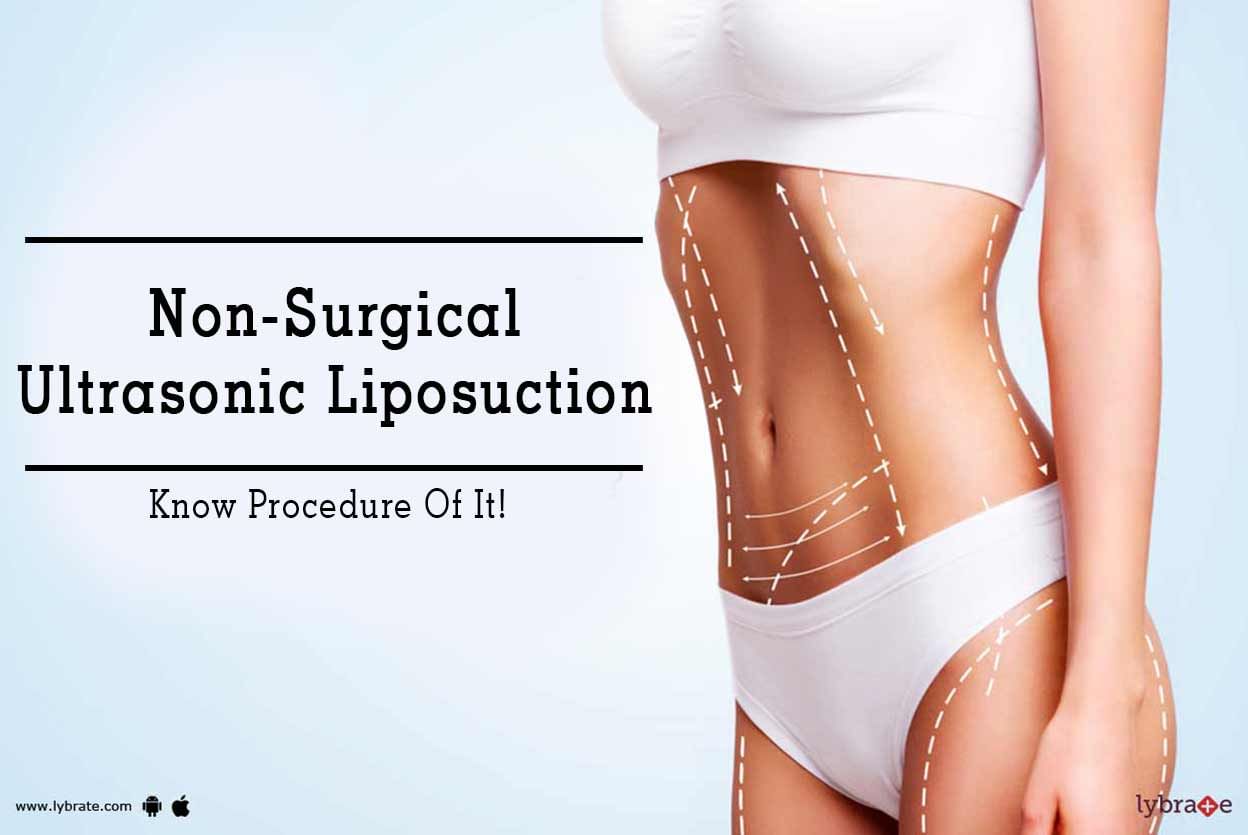 Non-Surgical Ultrasonic Liposuction - Know Procedure Of It!