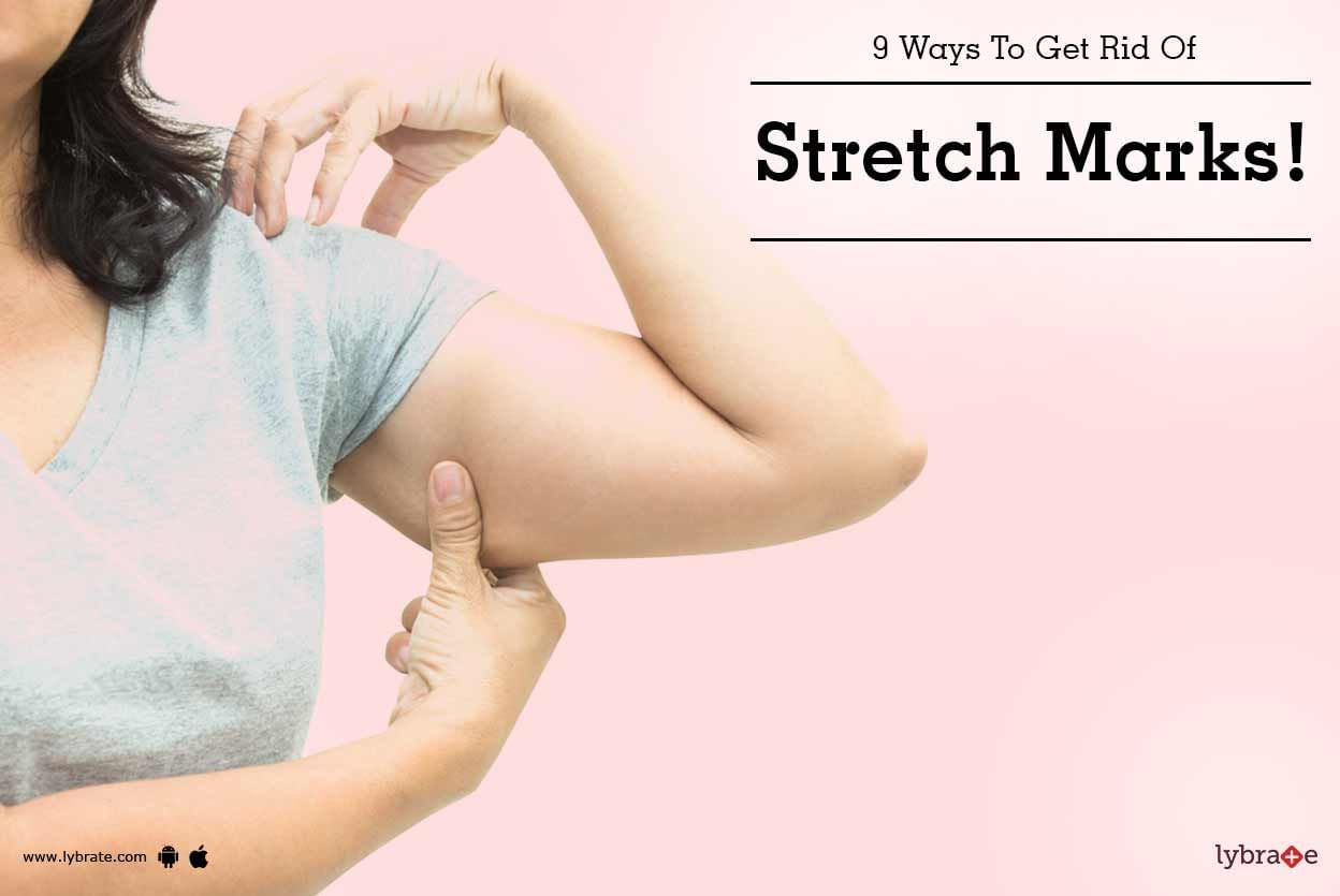 9 Ways To Get Rid Of Stretch Marks!