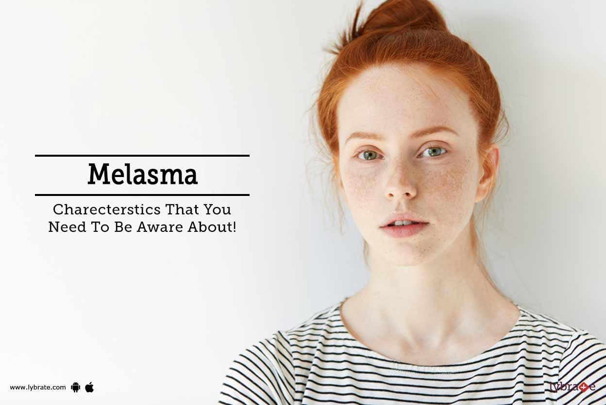 Melasma - Charecterstics That You Need To Be Aware About!