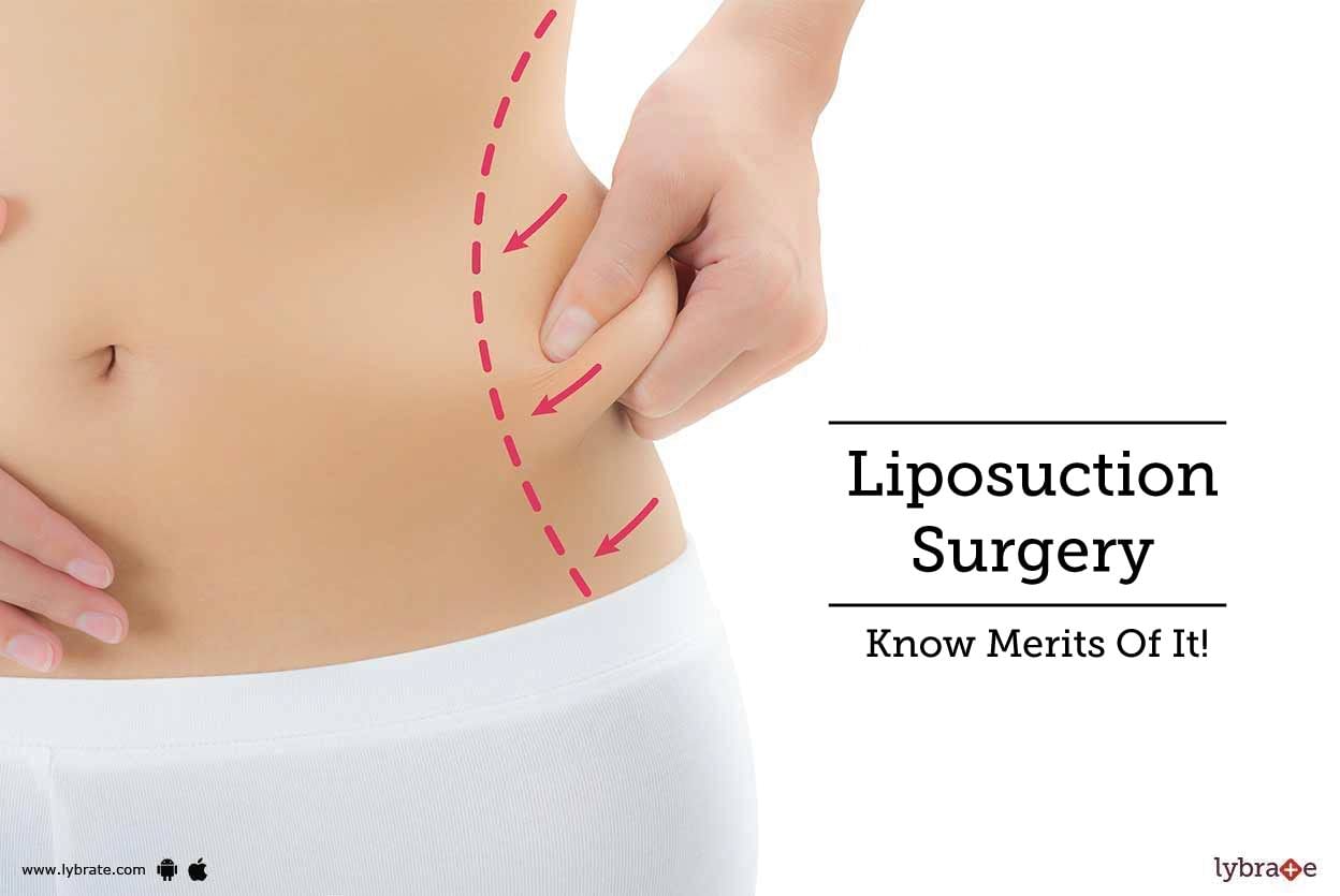 Liposuction Surgery - Know Merits Of It!