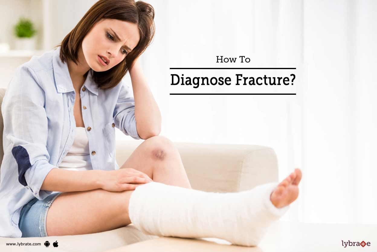 How To Diagnose Fracture?