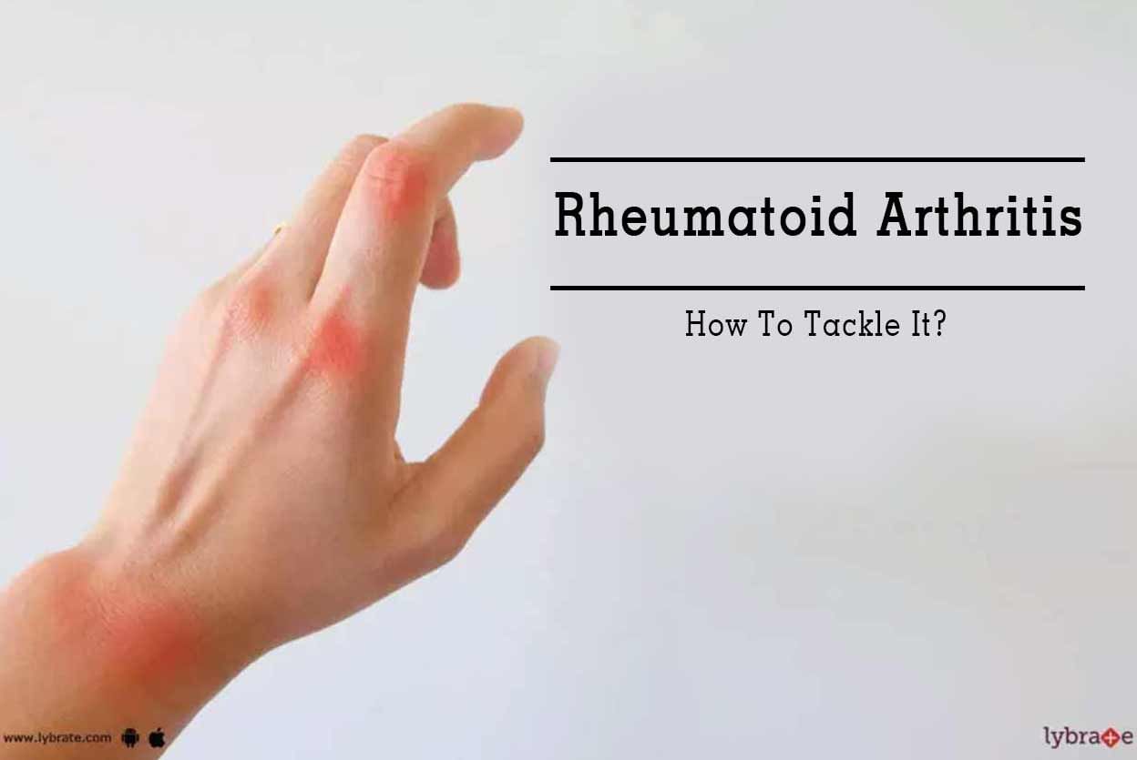 Rheumatoid Arthritis - How To Tackle It?