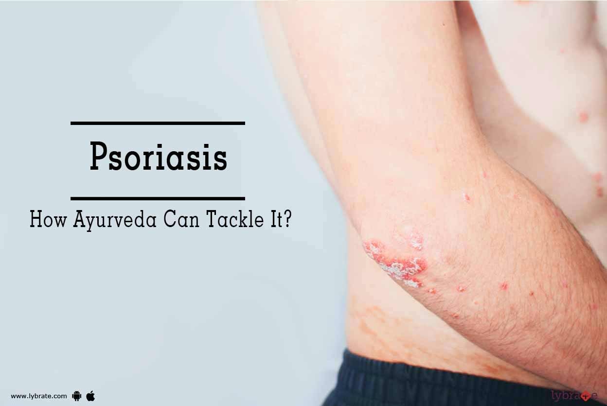 Psoriasis - How Ayurveda Can Tackle It?