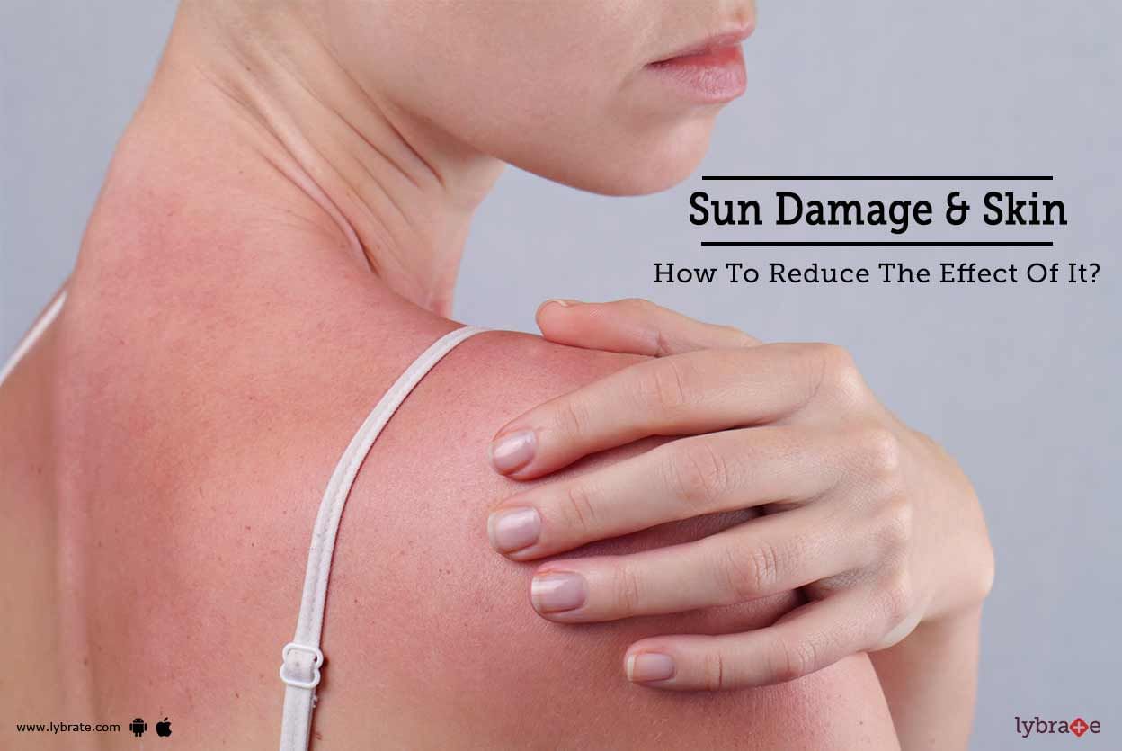 Sun Damage & Skin - How To Reduce The Effect Of It?