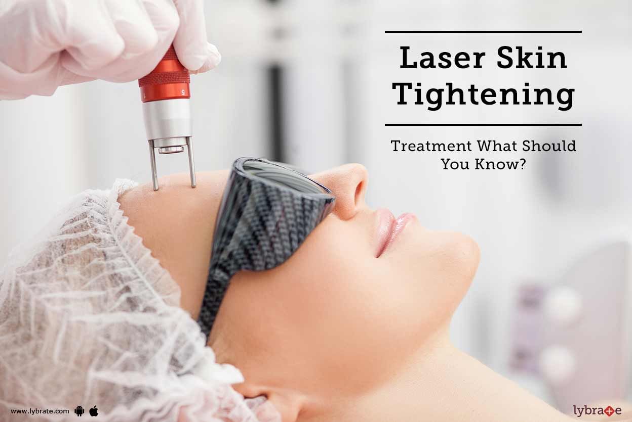 Laser Skin Tightening Treatment: What Should You Know?