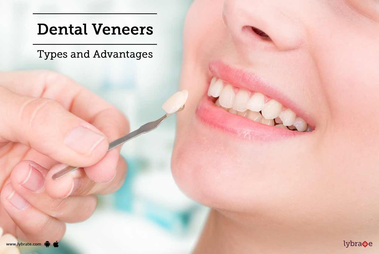 Dental Veneers - Types and Advantages