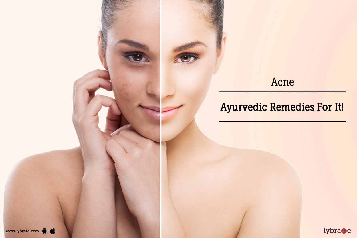 Acne - Ayurvedic Remedies For It!