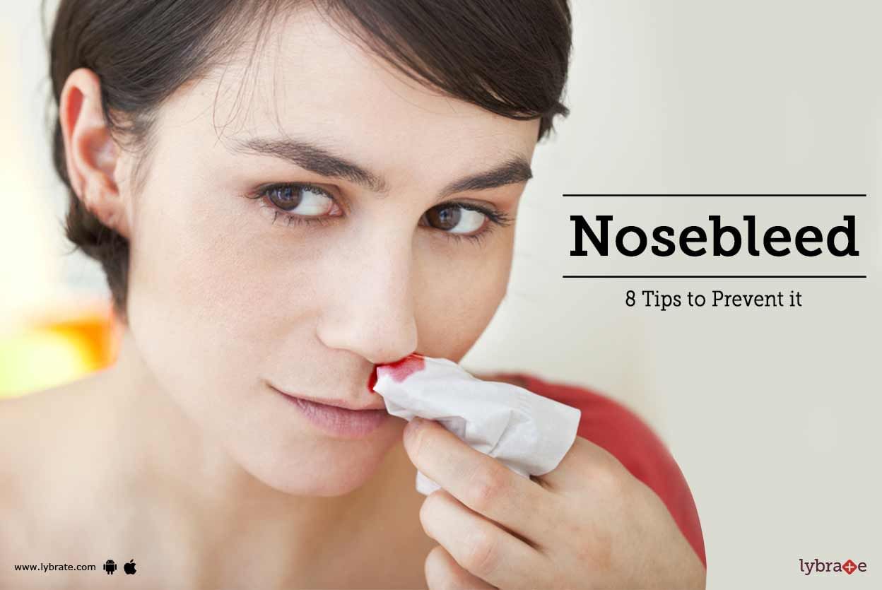 Nosebleed - 8 Tips to Prevent it