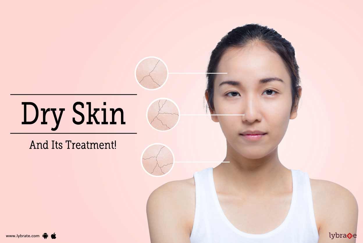 Dry Skin And Its Treatment!