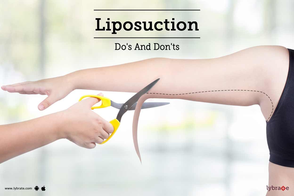 Liposuction: Do's And Don'ts