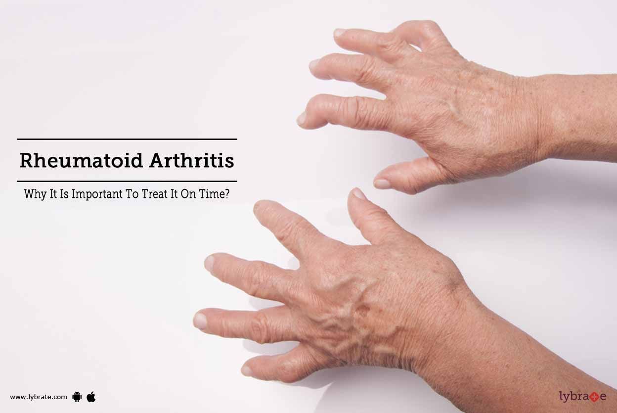 Rheumatoid Arthritis - Why It Is Important To Treat It On Time?
