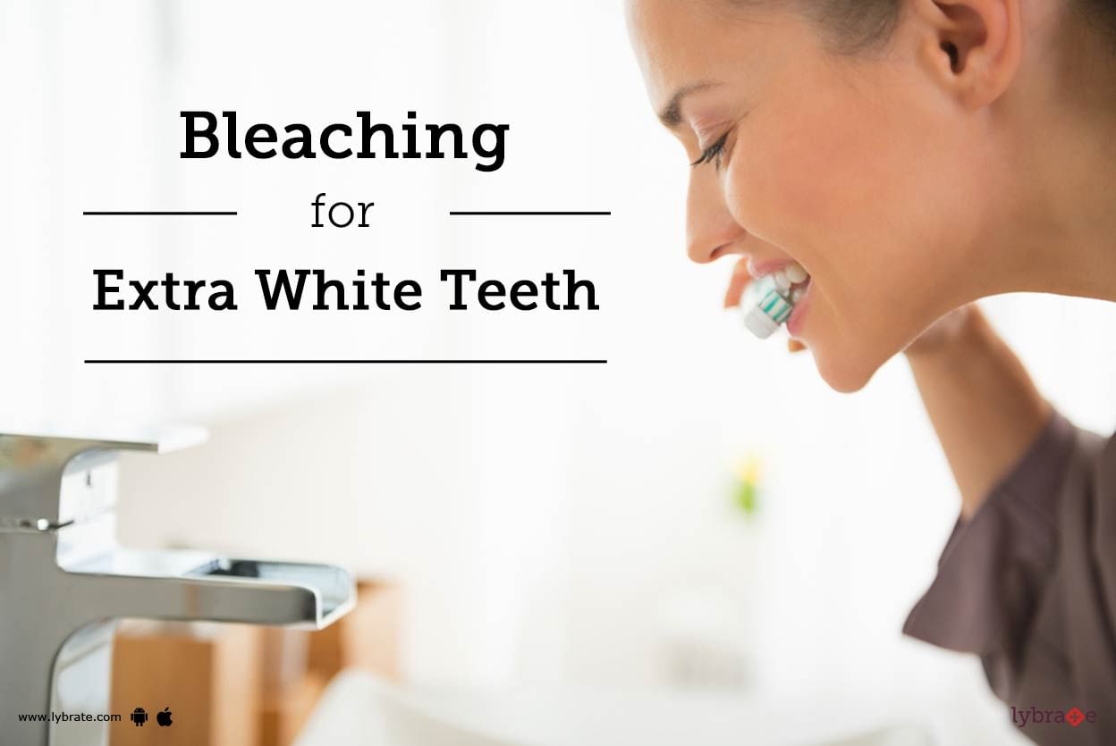 Bleaching for Extra White Teeth