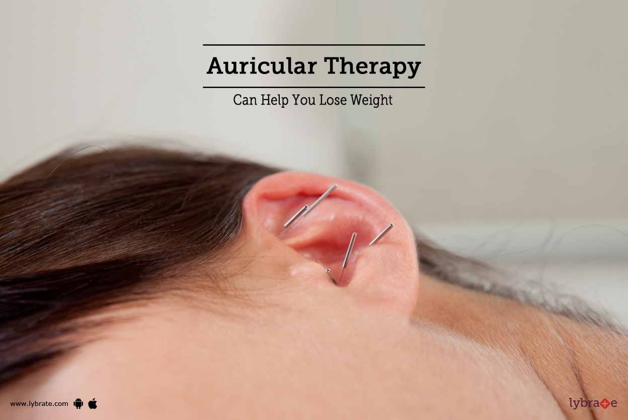 Auricular Therapy Can Help You Lose Weight