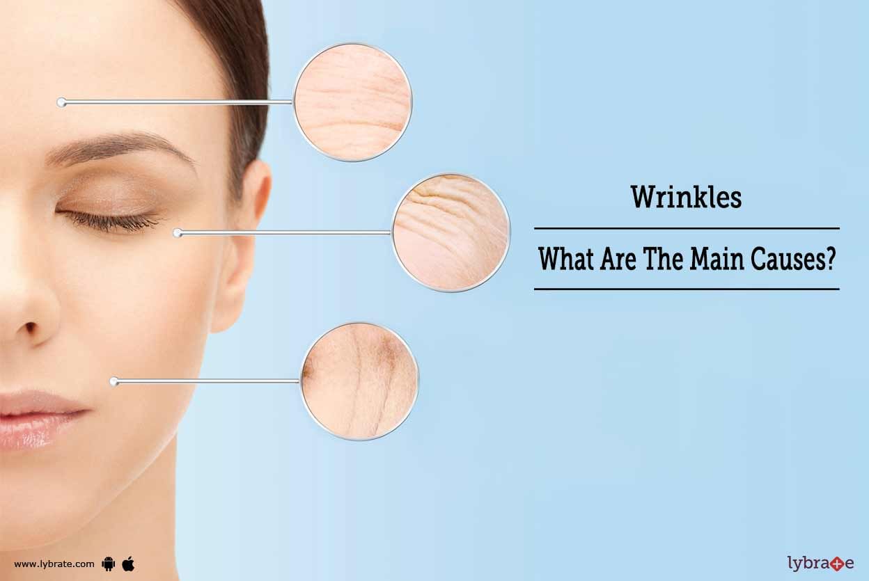 Wrinkles: What Are The Main Causes?