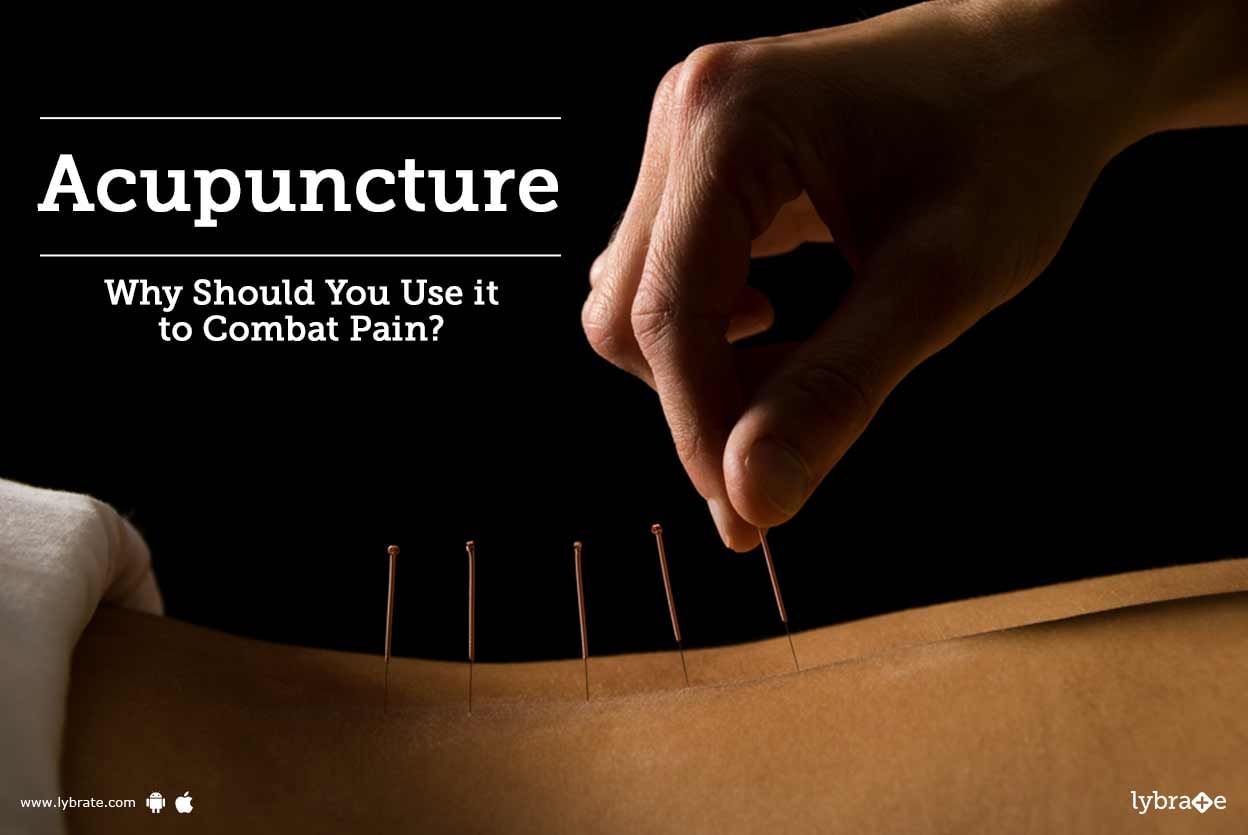 Acupuncture - Why Should You Use it to Combat Pain?